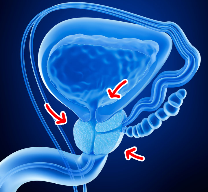 Biopsia prostata fusion: il tumore della prostata nel mirino della tecnologia