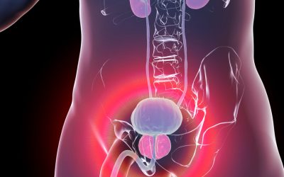 Tecnica Rezum prostata: come trattare efficacemente l’iperplasia prostatica benigna con il vapore acqueo